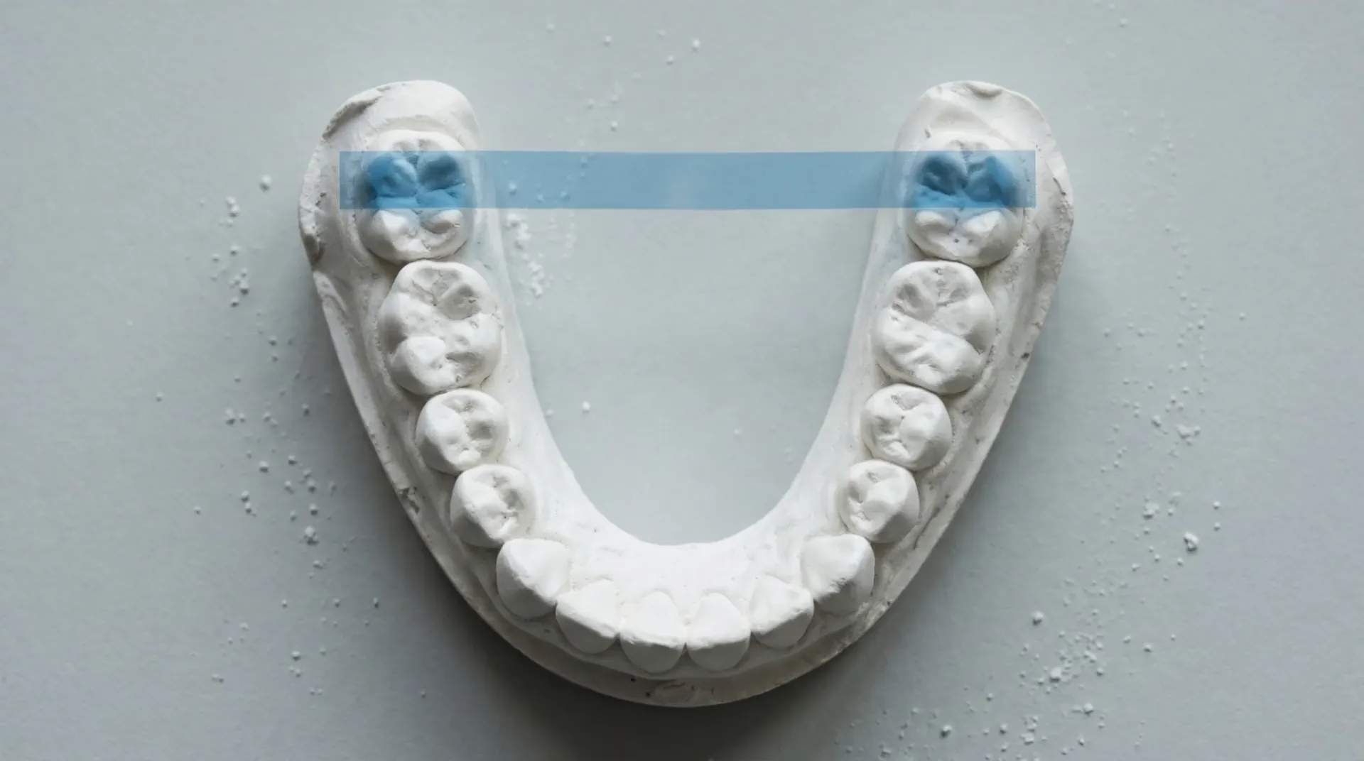 Illustrative gypsum lower arch cast with blue articulating film on a pale gray bench